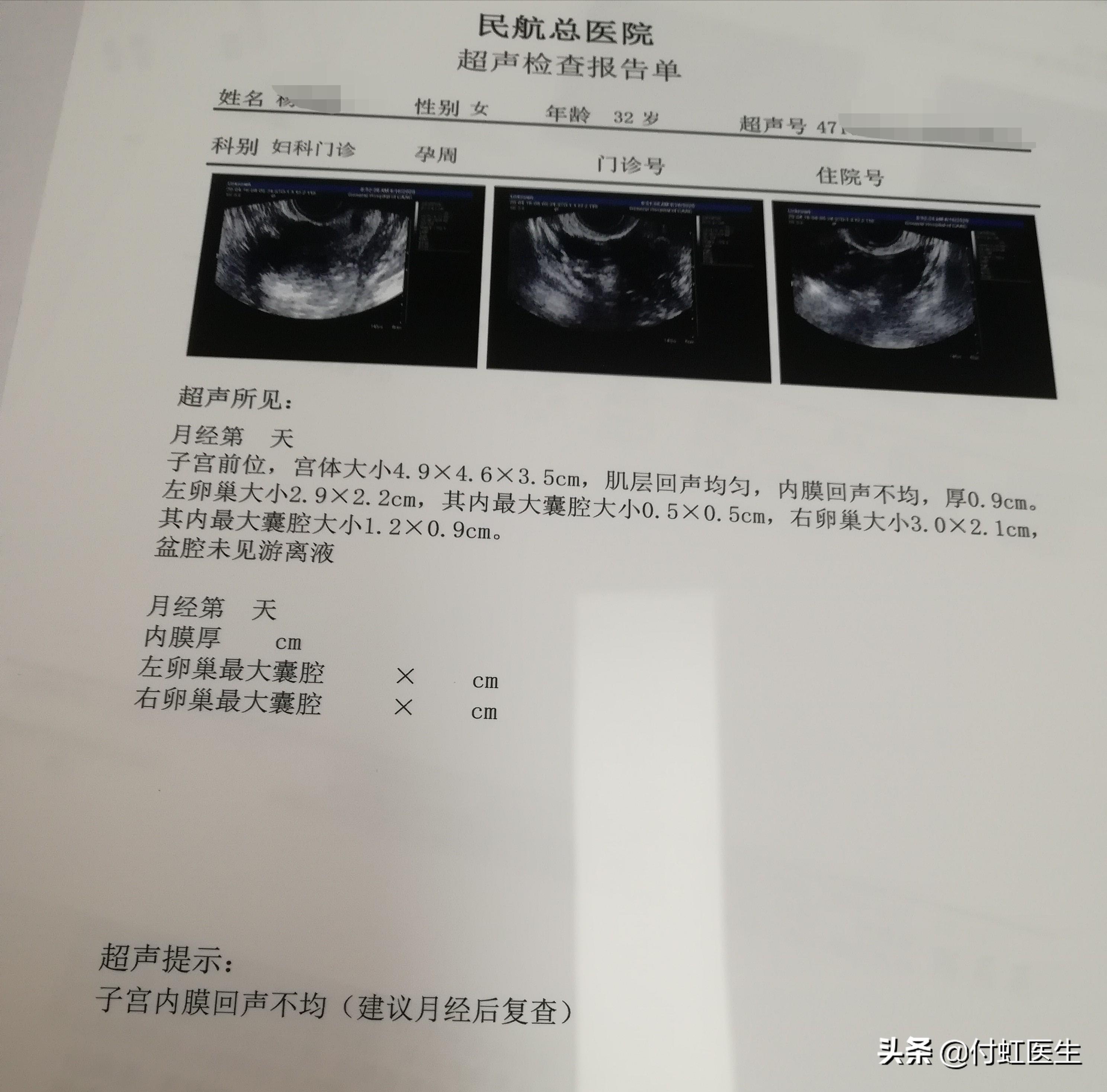 最新B超單，解讀孕期胎兒健康狀況的關(guān)鍵所在